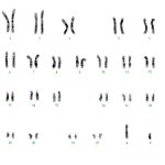 humankaryotype
